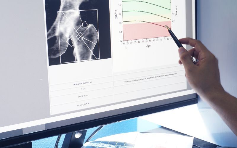 骨粗鬆症の薬と歯科の関係｜香川県 高松市の噛み合わせ専門歯科医院　吉本歯科医院
